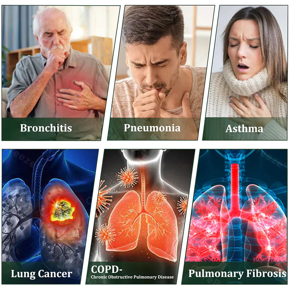 🇺🇸 𝐏𝐫𝐨𝐮𝐝𝐥𝐲 𝐌𝐚𝐝𝐞 & 𝐒𝐡𝐢𝐩𝐩𝐞𝐝 𝐢𝐧 𝐭𝐡𝐞 𝐔𝐒A✅𝐌𝐮𝐫𝐰𝒐𝒏® 𝐁𝐨𝐭𝐚𝐧𝐢𝐜𝐚𝐥 𝐌𝐮𝐥𝐥𝐞𝐢𝐧 𝐋𝐮𝐧𝐠 𝐂𝐥𝐞𝐚𝐧𝐬𝐞 𝐃𝐢𝐟𝐟𝐮𝐬𝐞𝐫🔥(👨‍⚕️Cough, Pharyngitis, shortness of breath, sputum, stuffy nose, bronchitis, bronchitis, allergy symptoms, lung discomfort)5❤️